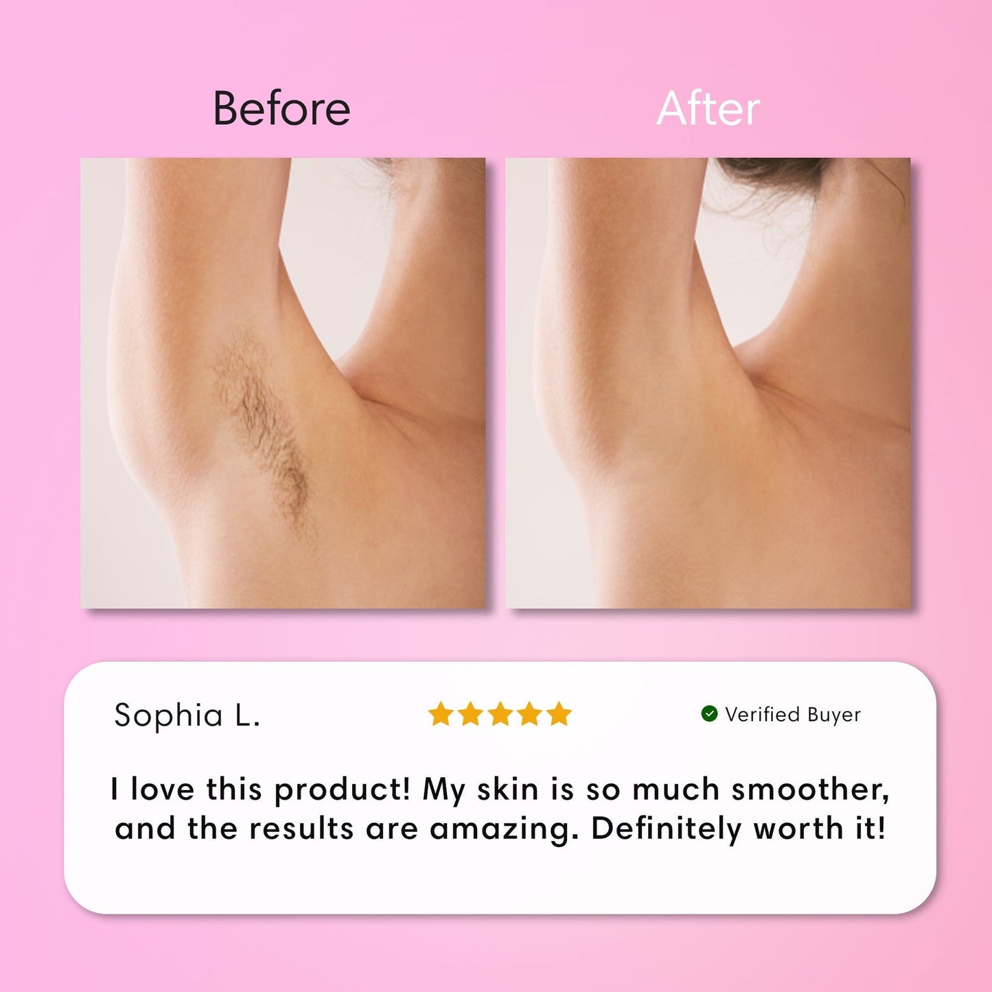 Cossetcare Hair Removal Cream | Gentle 5-Minute Body Hair Removal