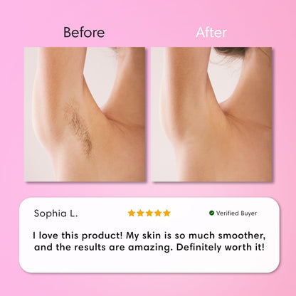 Cossetcare Hair Removal Cream | Gentle 5-Minute Body Hair Removal
