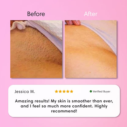 Cossetcare Hair Removal Cream | Gentle 5-Minute Body Hair Removal