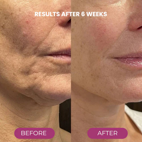🔥LAST DAY 50% OFF!!✨ Buy More, Save More｜Smooth, Firm & Glow with Nexisify Multi Balm 💜