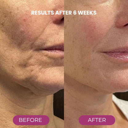 🔥LAST DAY 50% OFF!!✨ Buy More, Save More｜Smooth, Firm & Glow with Nexisify Multi Balm 💜