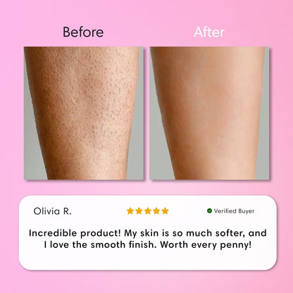 Cossetcare Hair Removal Cream | Gentle 5-Minute Body Hair Removal