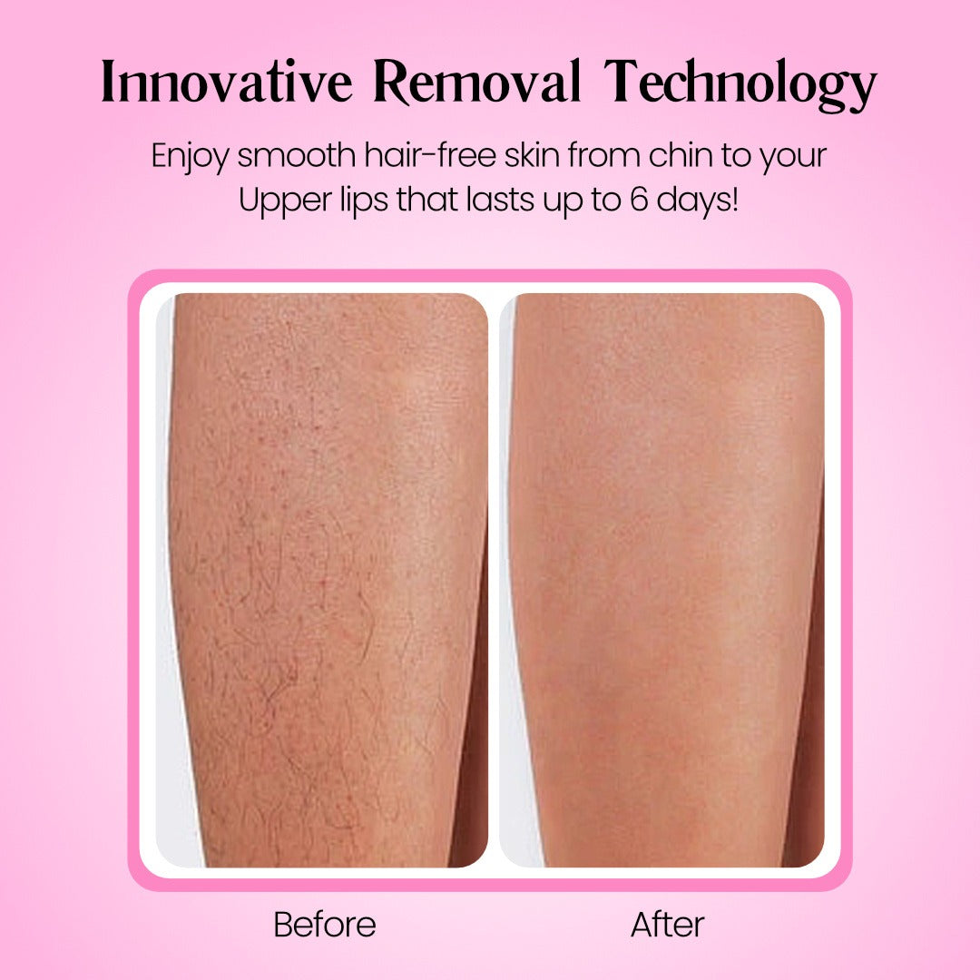 Cossetcare Hair Removal Cream | Gentle 5-Minute Body Hair Removal