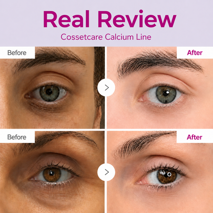 🔥LAST DAY 50% OFF!!Cossetcare Korean Calcium Dark Spot Eye Cream