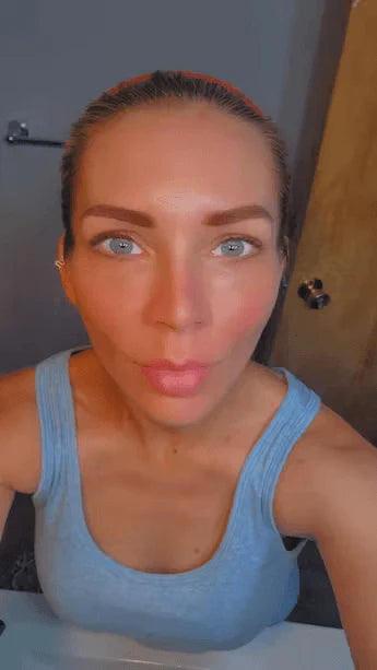 Customer skin result photo
