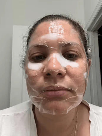 Customer skin result photo