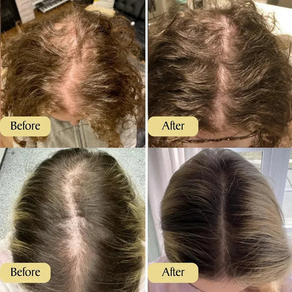 [NEW]Nexisify  Scalp Serum |Korean Hair Care
