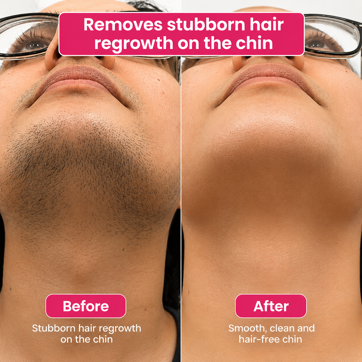 🔥LAST DAY 60% OFF Cossetcare Hair Reduction Oil 60 ml – Permanent Hair Removal Oil