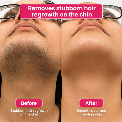 🔥LAST DAY 60% OFF Cossetcare Hair Reduction Oil 60 ml – Permanent Hair Removal Oil