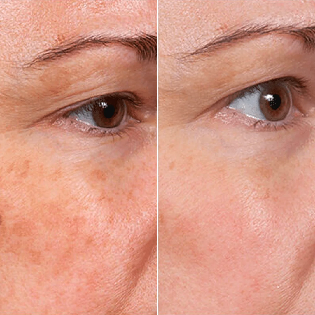 🔥LAST DAY 50% OFF!!Nexisify Rejuvenate Face Serum