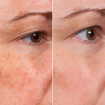 🔥LAST DAY 50% OFF!!Nexisify Rejuvenate Face Serum
