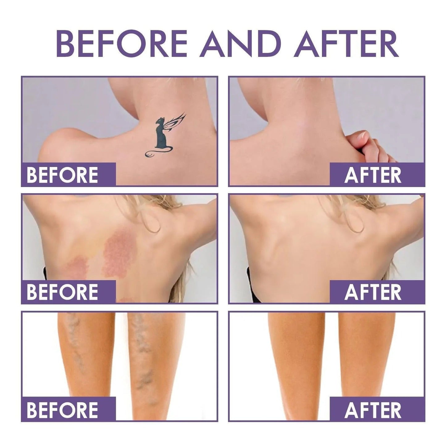 💜Last Day-Buy 1 Get 1 Free!💜✨Body Coverage Perfector – Waterproof, Lightweight & Flawless Body Makeup