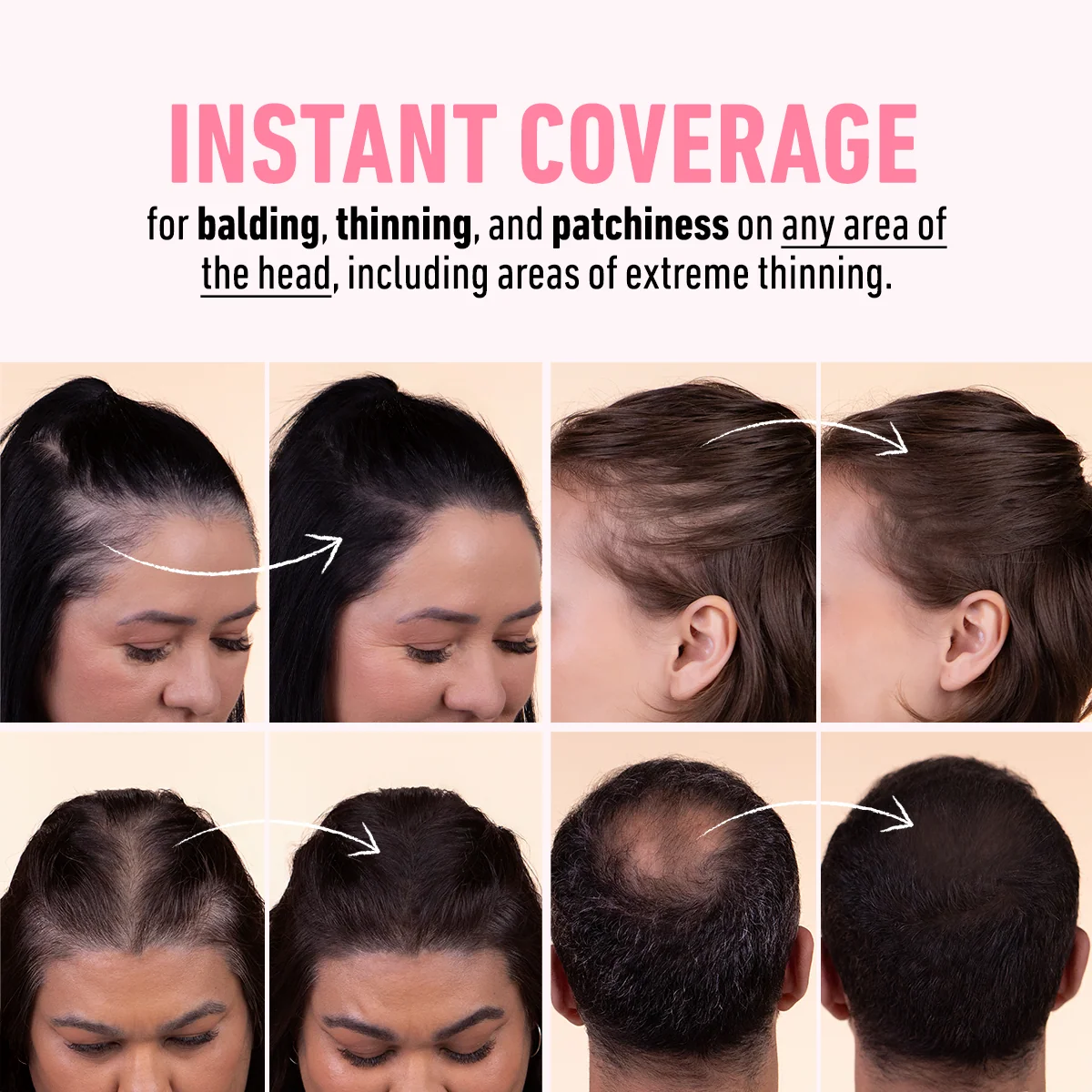 🔥Last Day 50% OFF!!Nexisify Hairline contouring powder-Instant, Natural Coverage for thinning hair and roots